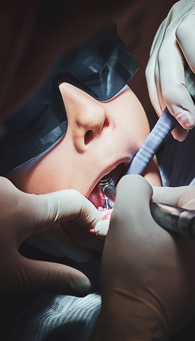 cirurgia oral cirurgia oral